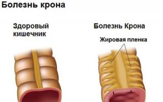 Эффективные таблетки от диареи